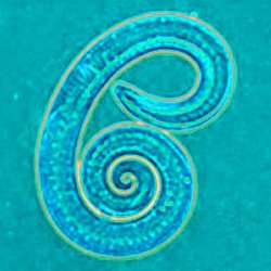 Trichinella spiralis larvası