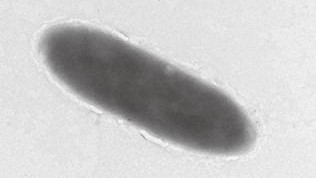 petrol yiyen bakteri: Mariana Çukuru'nun en derin noktasından alınan yeni örnekler petrol yiyen bakterileri gösterdi 