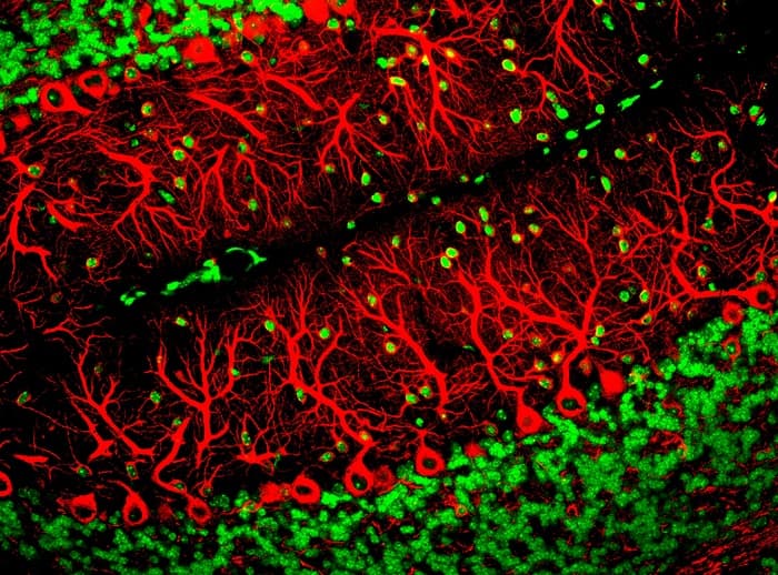 Modern boyama teknikleri yardımıyla görülen Purkinje hücresi (yeşil). Purkinje'nin zamanındaki boyama teknikleri ve mevcut mikroskoplar sebebiyle hücrenin sadece büyük gövdesini görüp tek bir Purkinje hücresinin dallanmasını görememiş olması bilimin ironilerinden biridir.