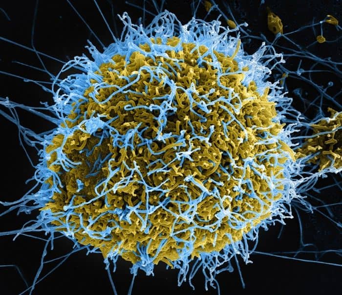 Bir hücreye (sarı) bulaşmış Ebola virüsü parçacıkları (mavi)