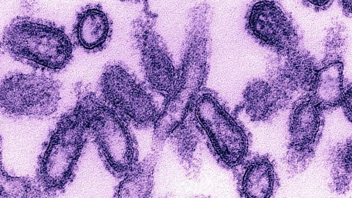 ispanyol gribi virüsü görüntüsü h1n1