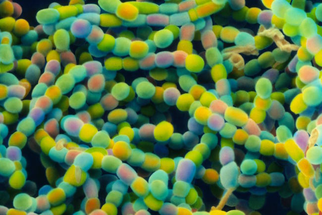 Bu toprak bakterileri Streptomyces spor zincirlerinin renkli taramalı elektron mikroskobu mikrografisidir (SEM)