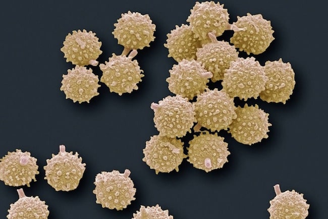 Kurtmantarı mantar sporlarının renkli taramalı elektron mikroskobu görüntüsü (SEM). Gördükleriniz mantarın üreme hücreleridir