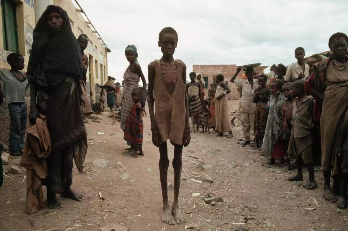 Somali iş savaşından kaynaklanan açlığın kurbanları