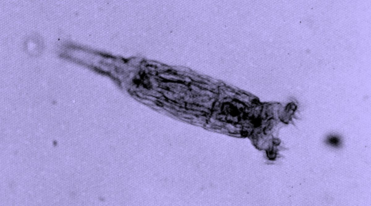 24.000 yaşındaki rotifer