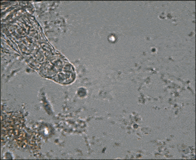 Sıvıda yüzen rotifer mikroorganizmasının görüntüsü.