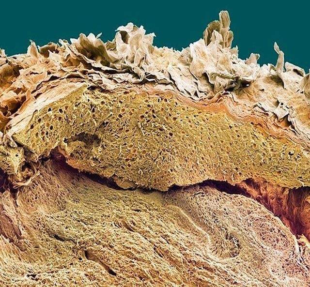 Elektron mikroskobu altında ölü deri hücreleri.