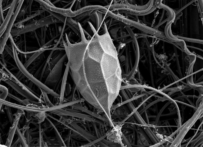 Rotifer Keratella cochlearis'in loculası, taramalı elektron mikroskobu görüntüsü