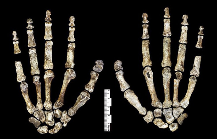 Homo naledi modern insan ve beçin özelliklerini bir arada taşıyor.