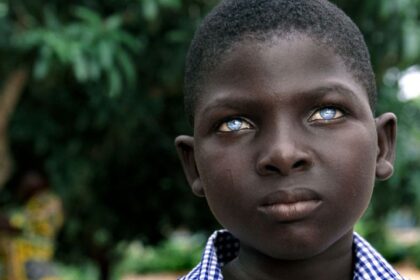 mavi gözlü siyahi zenci erkek