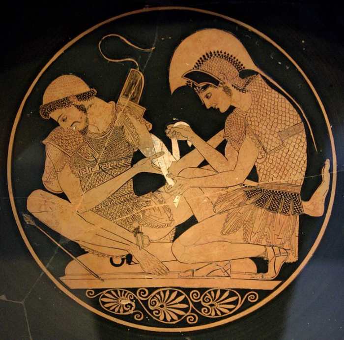 Aşil, Patroclus'u bandajlıyor, MÖ 500. İnsanlık enfeksiyonları önlemeyi nasıl başardı?