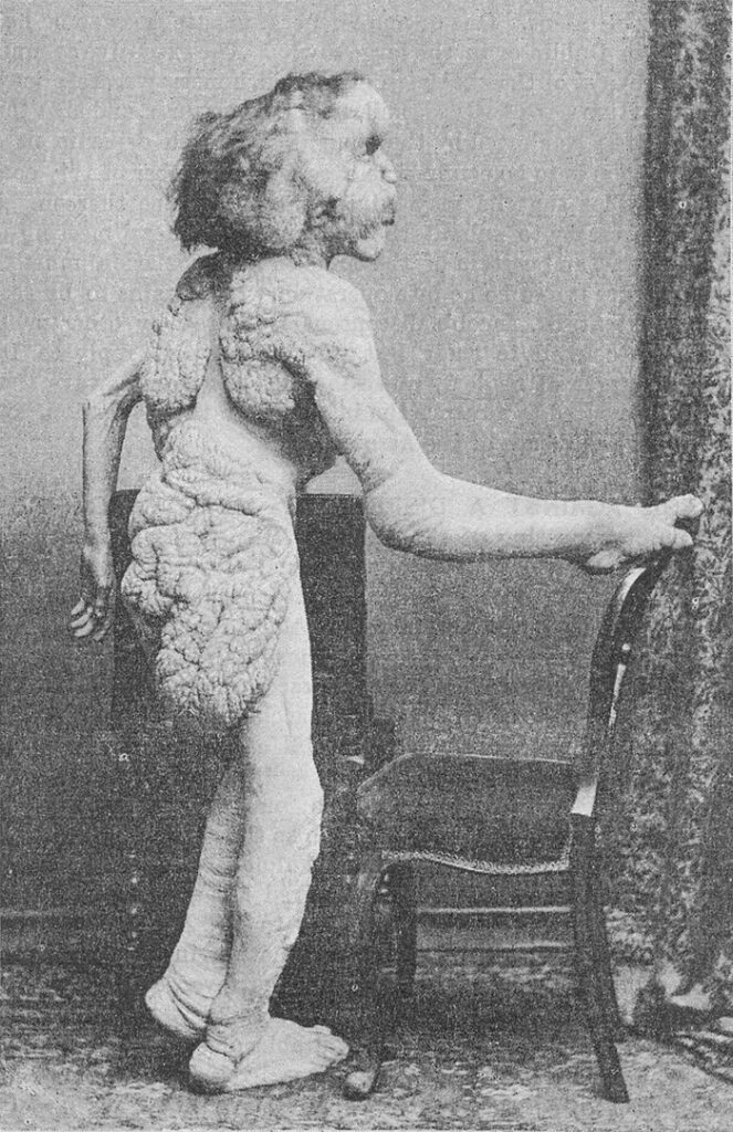 Joseph'in 1888'de çekilen bir fotoğrafı.