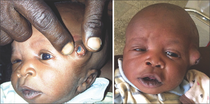 afrika üç gözlü doğan bebek