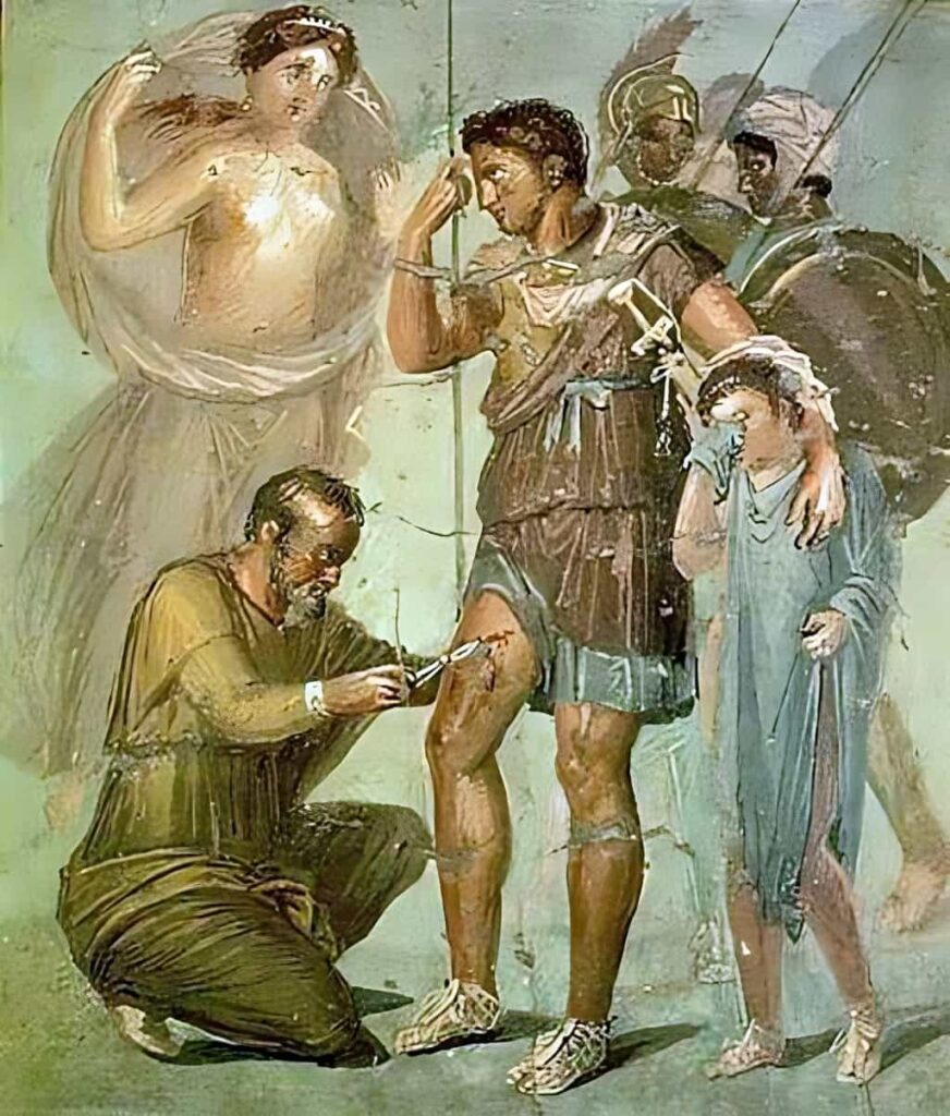Pompeii'den Iapyx, Aeneas'ın bacağındaki ok başını çıkarıyor, 
