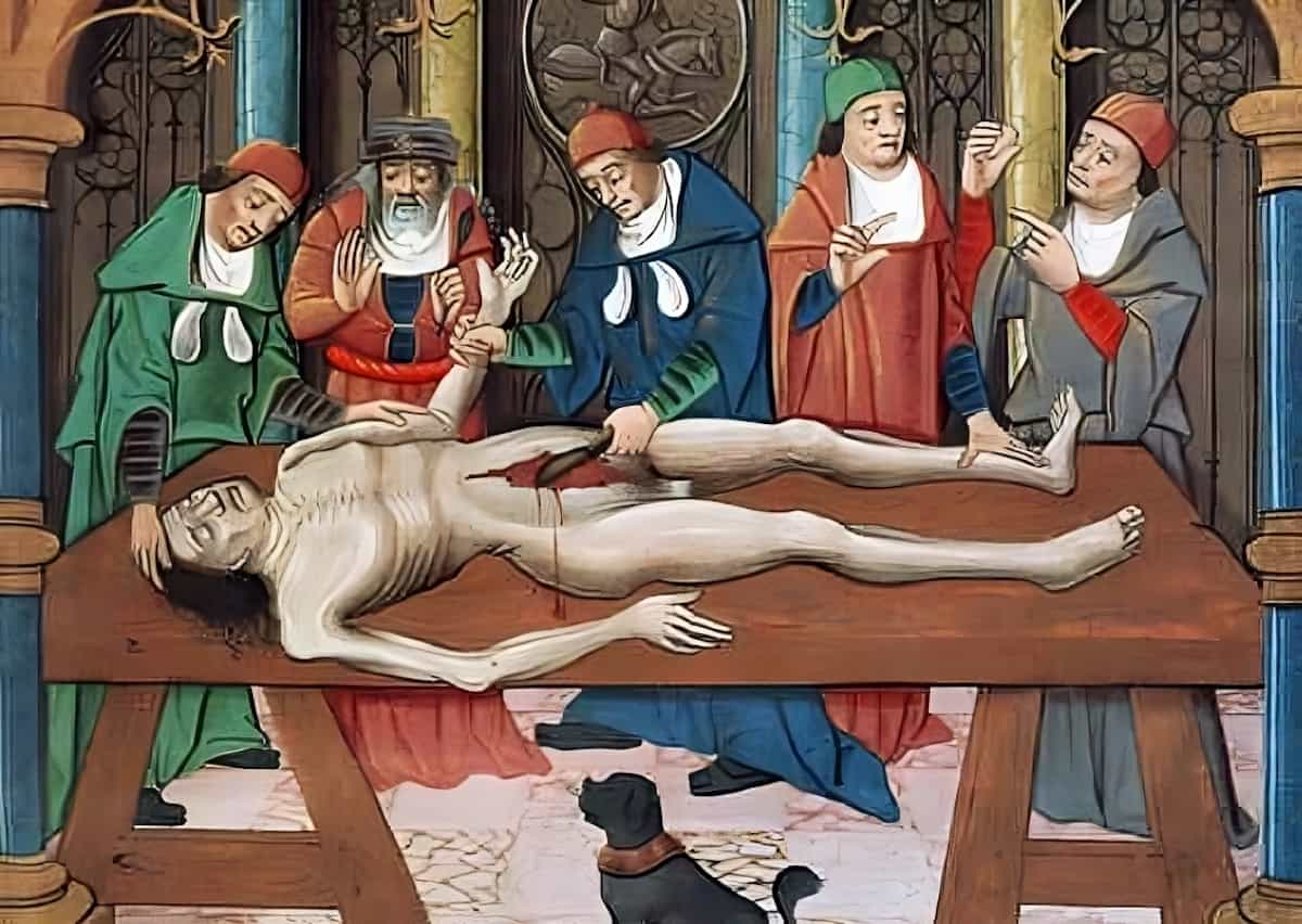 Bir kadavranın diseksiyonu, 15. yüzyıl tablosu.