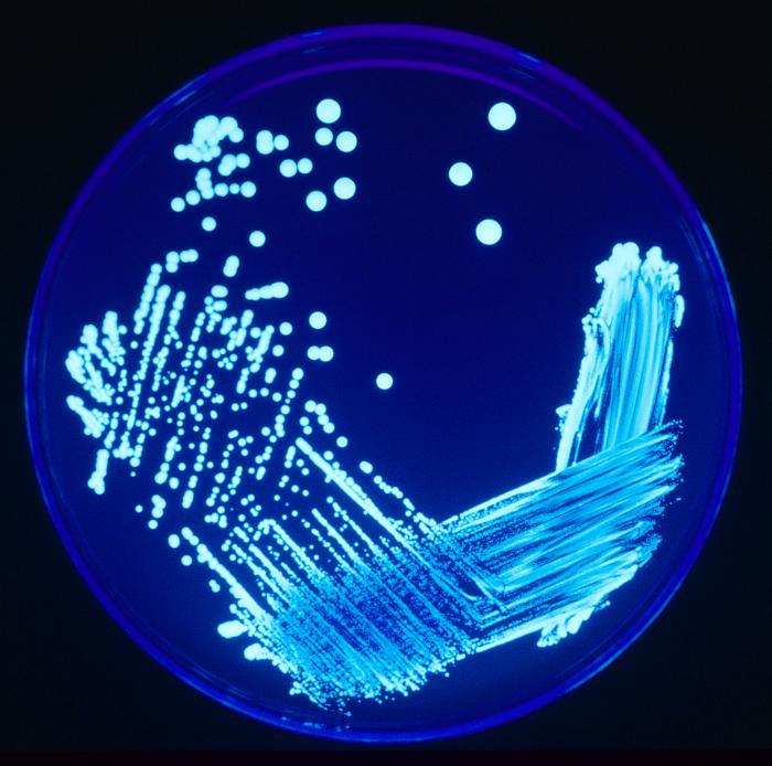 Çizgi plakası yöntemiyle yayılmış bakteri içeren bir agar plakası. Bakteriyoloji
