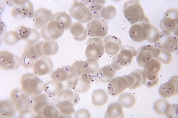 Kan mikroskop altında incelendiğinde, sıtma patojeni boyandıktan sonra görünür hale gelir.