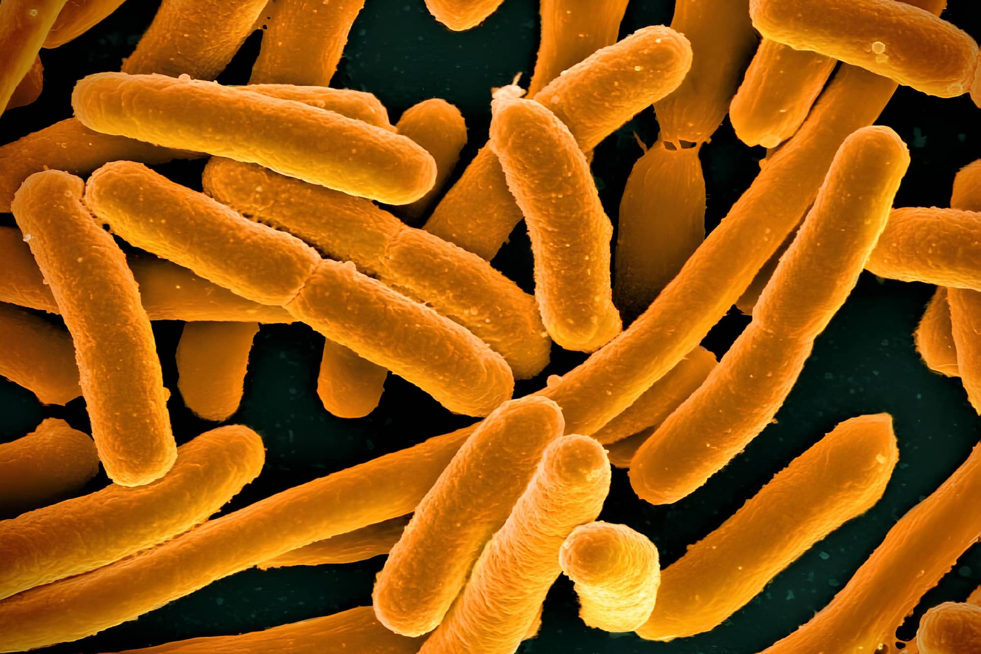 E. coli bakterisinin mikroskobik görüntüsü.