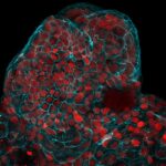Amniyotik sıvıdan büyütülmüş hücre topları