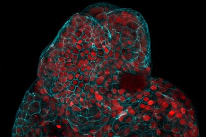 Amniyotik sıvıdan büyütülmüş hücre topları