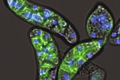 Amoebidium appalachense, F-aktini (yeşil) ortaya çıkarmak için phalloidin ve DNA'yı (mavi) ortaya çıkarmak için Hoescht ile boyanmıştır.