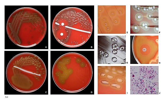 Streptococcus pneumoniae