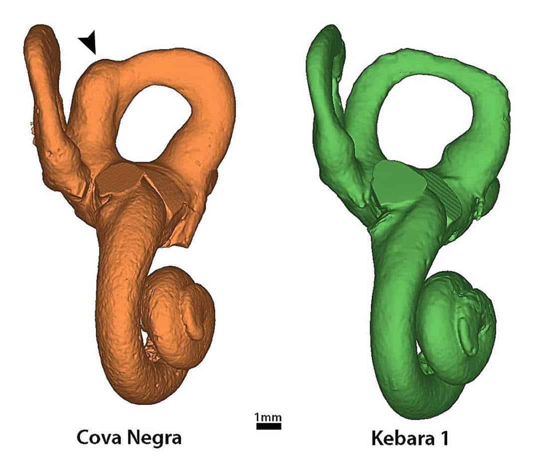 neandertal down sendromu