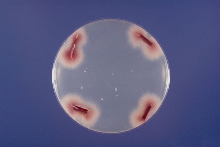 Fusarium oxysporum'un genomik yapısı 