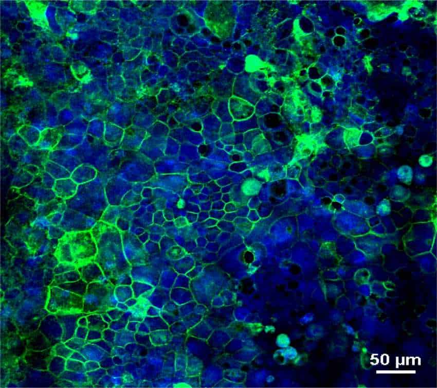 glütene verdiği tepkiyi incelemek için oluşturdukları organoidin iç kısmından bir görünüm