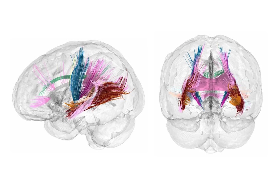 16PregnancyBrain fwqm superJumbo