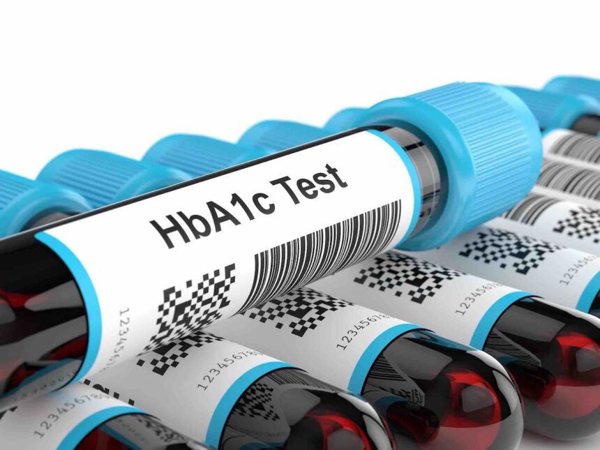 HbA1c test